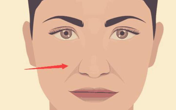 鼻翼外翻面相解析  女人最忌讳的五种鼻子